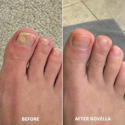Novella Oregano & Black Seed Oil